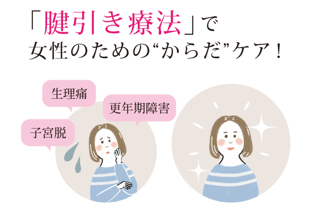 girl01-1024x673.png
